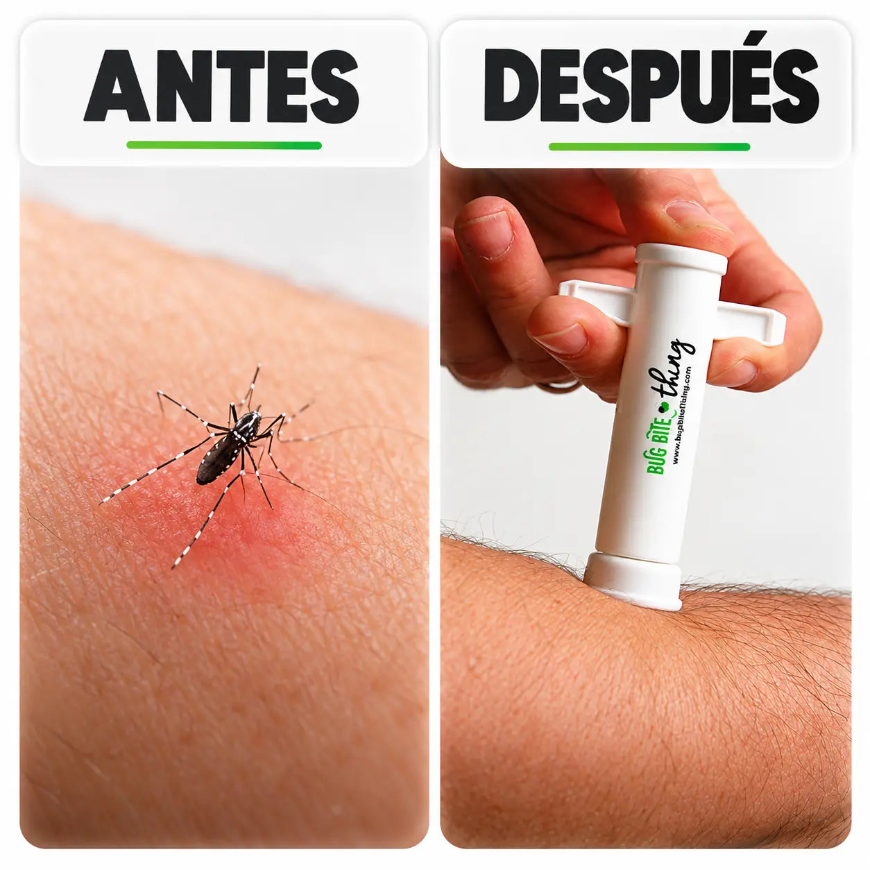 PICAVEX® Herramienta de Succión para Picaduras de Mosquitos e Insectos
