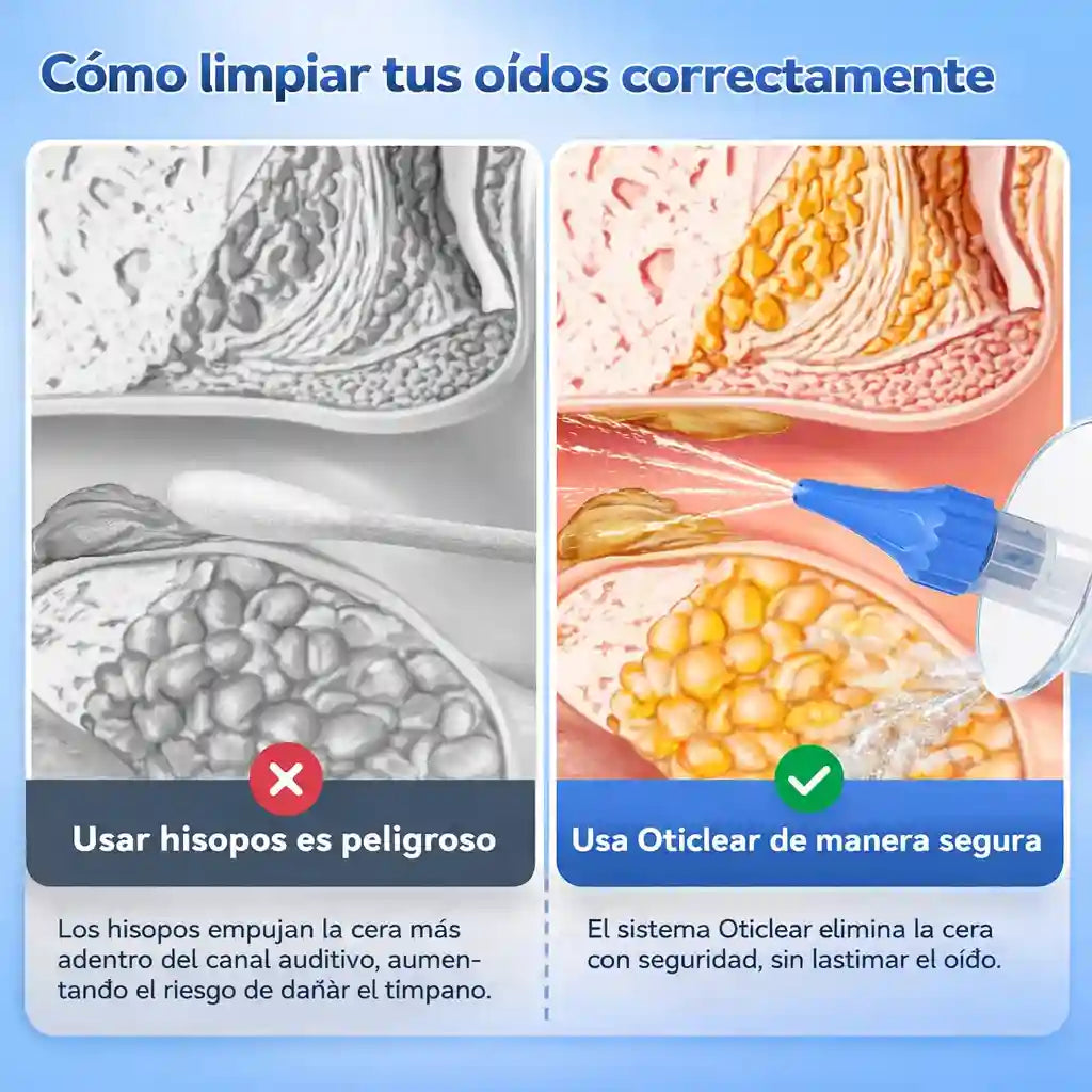 Oticlear® Limpieza Lavado De Oidos Kit Profesional